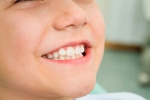 How You Can Prevent Your Toddler’s Tooth Decay