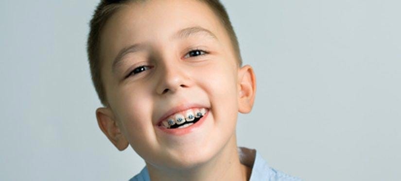 Braces for Kids