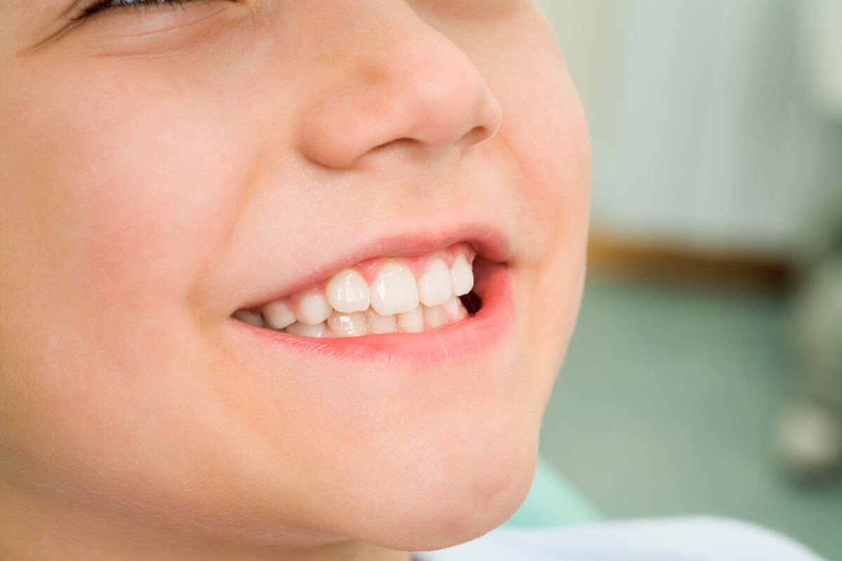 Pediatric Dentist in San Diego